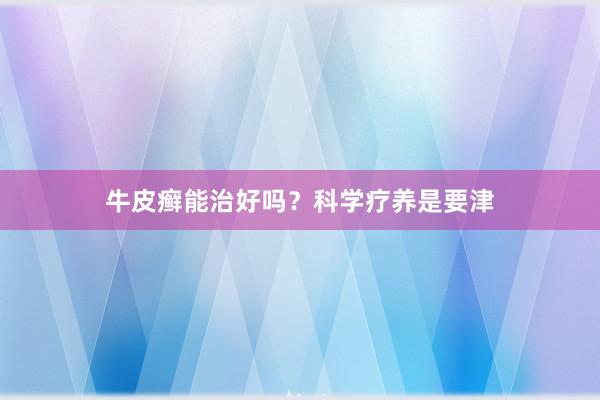 牛皮癣能治好吗？科学疗养是要津